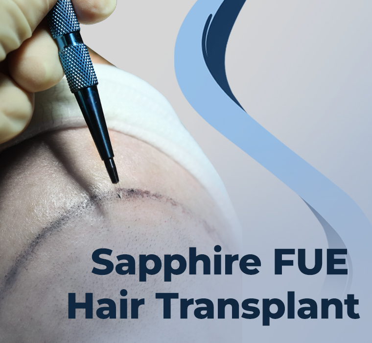 Sapphire FUE Hair Transplantation